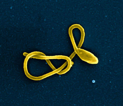 Ebola Virus Particle (43492898261)