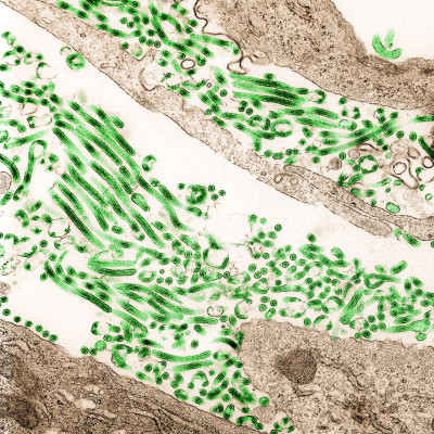 Ebola Virus Particles