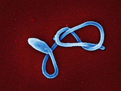 Ebola Virus Particle