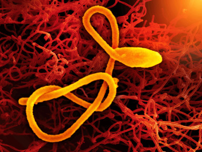 Ebola Virus