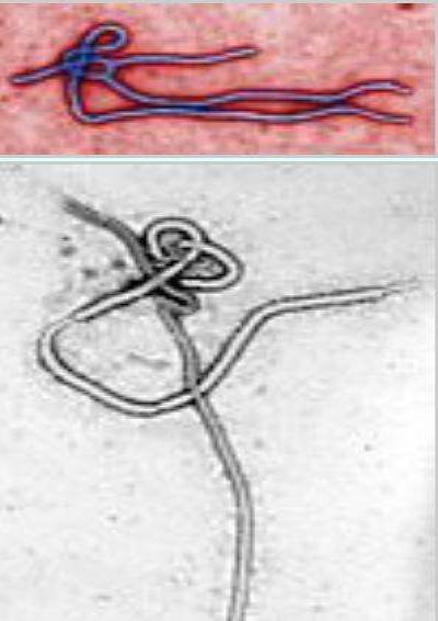 Ebola Virus