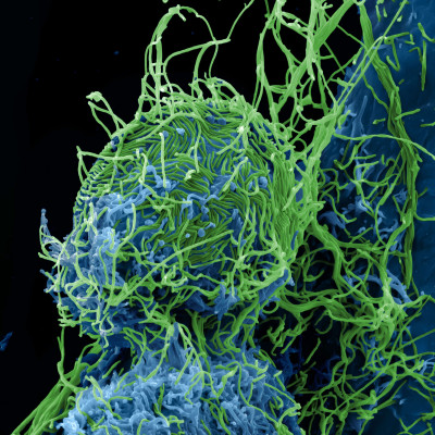 Ebola Virus Particles