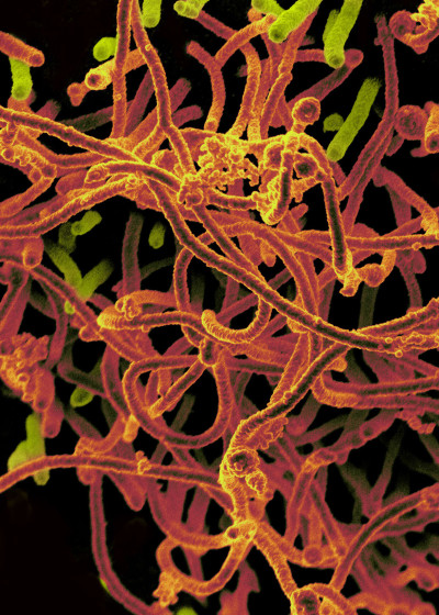 Ebola Virus From Mali Blood Sample