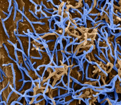 Ebola Virus Particles