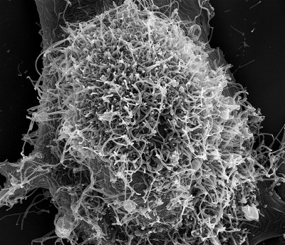 Scanning Electron Micrograph of Ebola Virus Particles