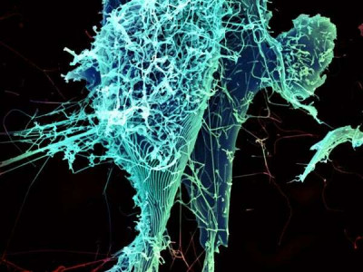 String-Like Ebola Virus Peeling off an Infected Cell