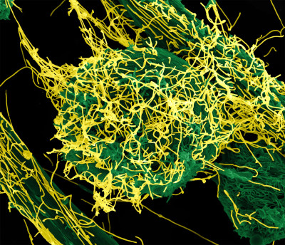 Ebola Virus Particles