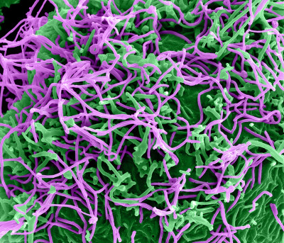 Ebola Virus Particles