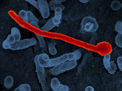 Ebola Virus Makona from West African Epidemic