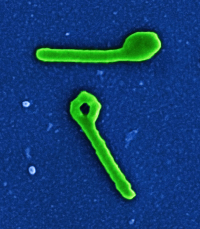 Two Ebola Virus Particles