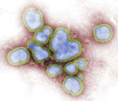 Transmission Electron Microscopic of Influenza A Virions