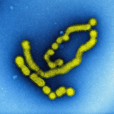 Swine Flu Strain Virus Particles