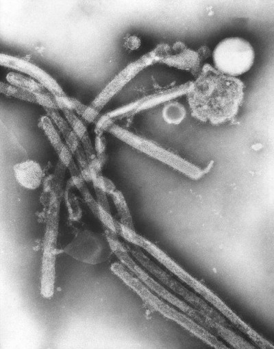 Transmission Electron Microscopic Image of Hong Kong Flu Virus