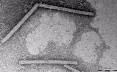 Electron Microscopy of Pepper Mild Mottle Virus RNA Positive Samples