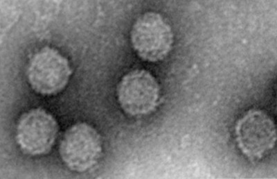 Viral Particle for Banna Virus HB14-71-01