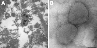 Electron Micrograph of Poxvirus Particles