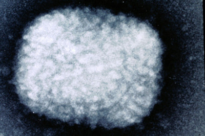 Electron Micrograph of Smallpox Virus