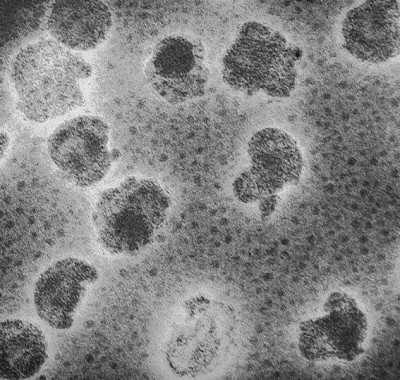 Electron Micrograph of Plasmavirus