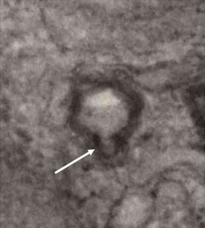 Putative Tail Structure in Emiliania Huxleyi Virus 86