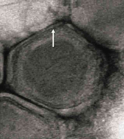 Emiliania Huxleyi Virus 86