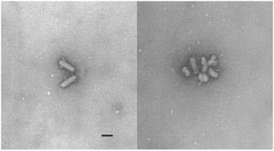 Electron Micrographs of Bellinger River Nidovirus Particles