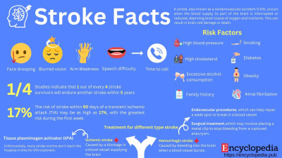 Stroke Facts