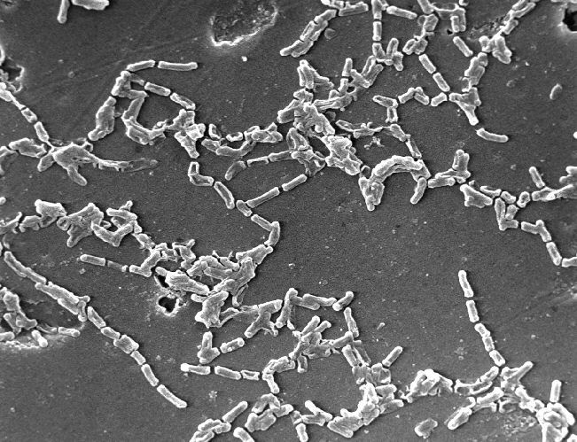 Mycobacterium chelonae | Encyclopedia MDPI