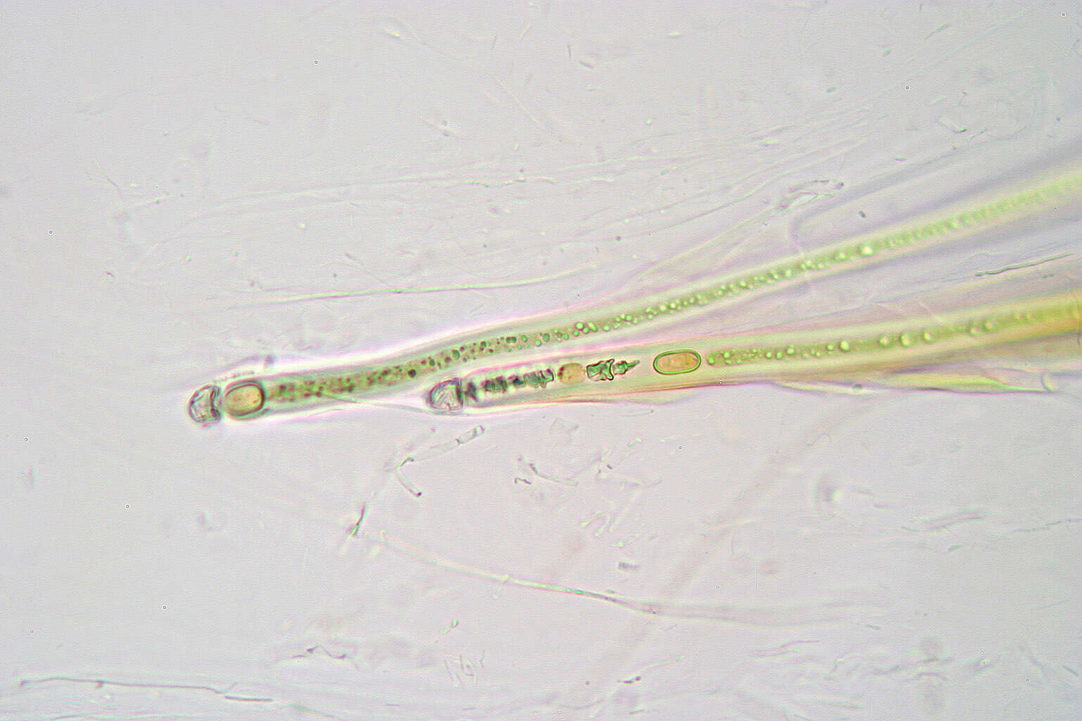 Trichomes - Magnified | Encyclopedia MDPI