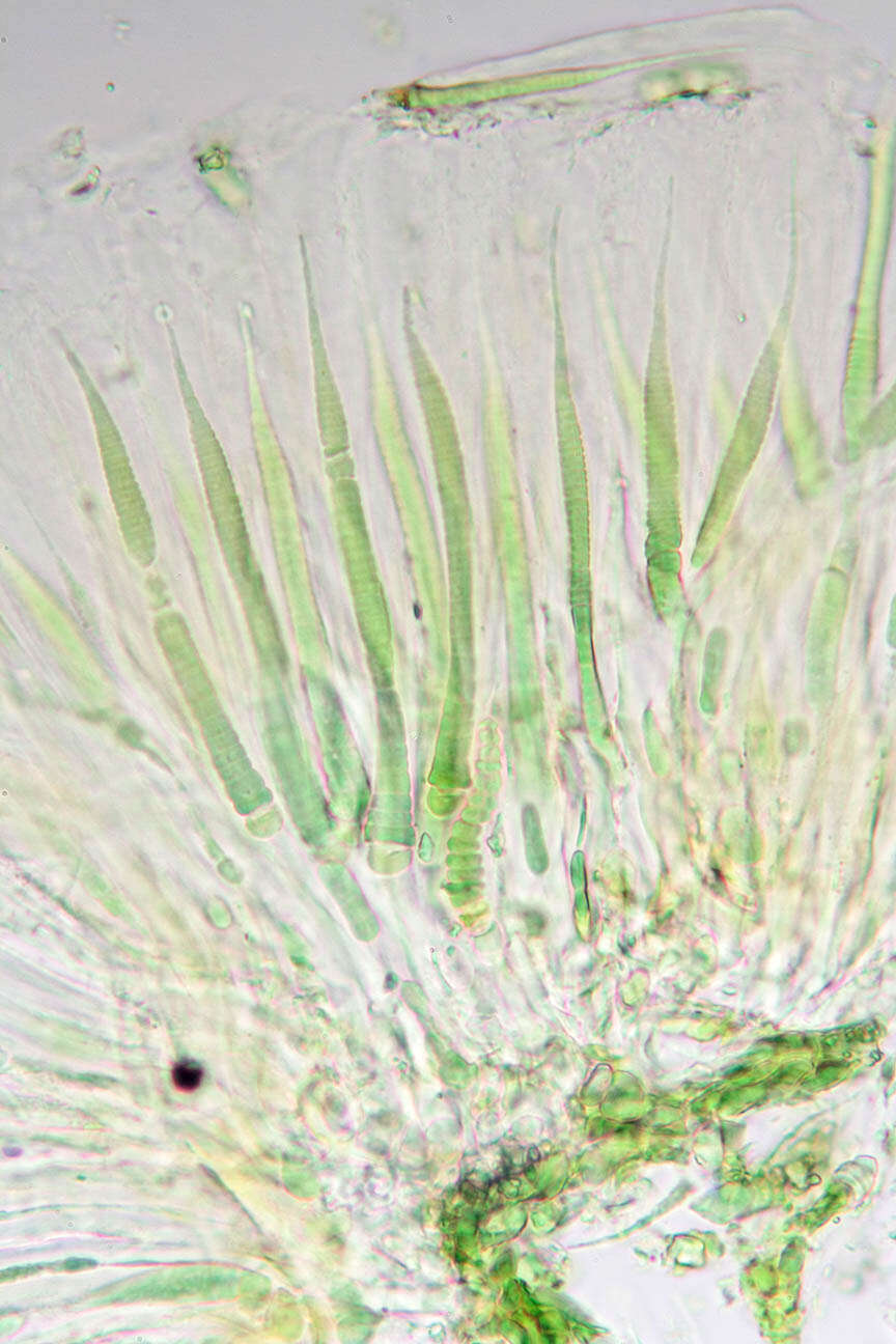 Magnified Trichomes | Encyclopedia MDPI