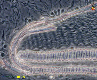 Motile Bacteria with Fine Flagella and Spiral Bodies