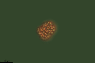 Little Flowers in the Water Drops, Snowella, Laguna Del Tejo