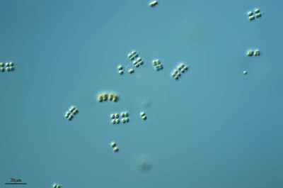 Merimopedia, Water Freckles