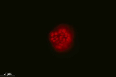 Little Flowers of the Raindrops, Snowella, Tejo Lagoon