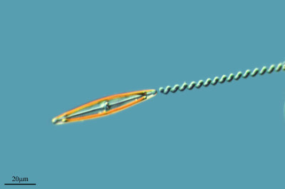 Navicula and Spirulina, Enchantment