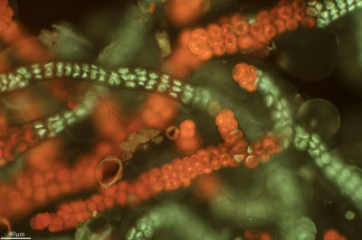 The Softest Skin, Stigonema, Ares Station