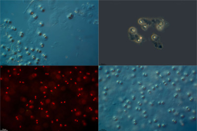 Cyanostylon Gelatinosus the Unique Life in a Martian Cave