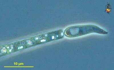 Apex of Cylindrospermopsis raciborskii