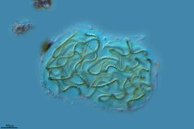 The Undecipherable Labyrinth of Nostoc