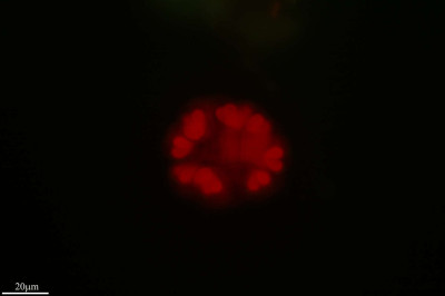 Some Bundles of Love, Gomphosphaeria aponina