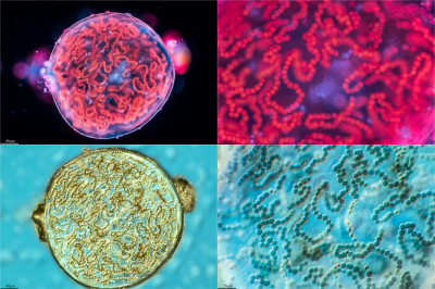 Nostoc Planets in the Anteroom of Mars, ARES Station