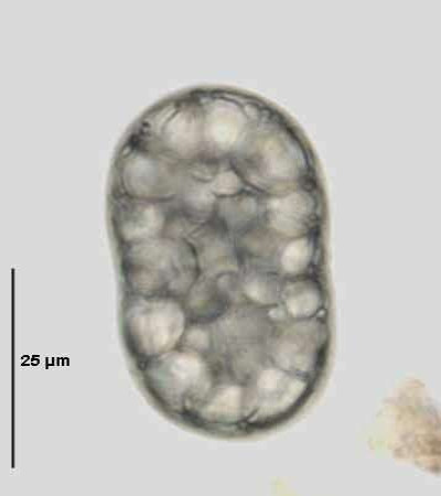 Achromatium oxaliferum