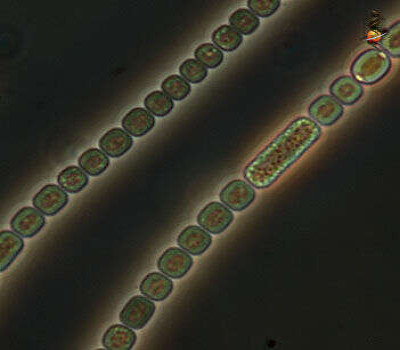 Filaments of Anabaena