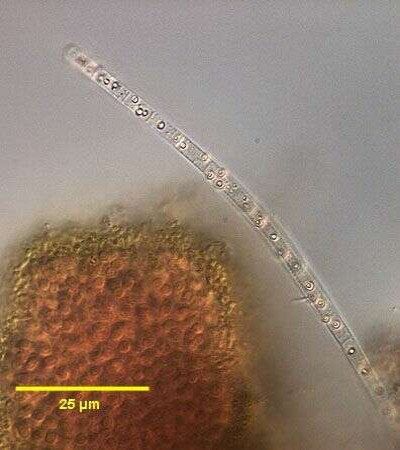 Elemental Sulfur Granules in <em>Beggiatoa alba</em>