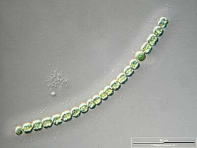 Portrait of Anabaena