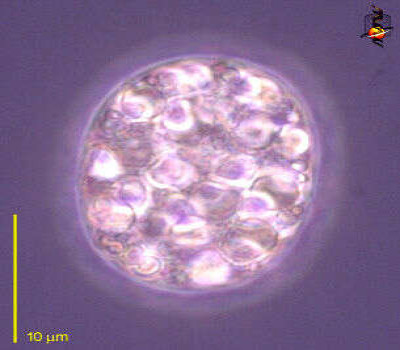 Portrait of Achromatium