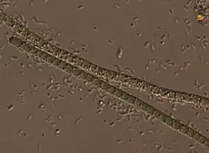 Two Fine Filaments of a Cyanobacterium