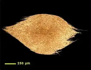 Aphanizomenon Phase Contrast Micrograph