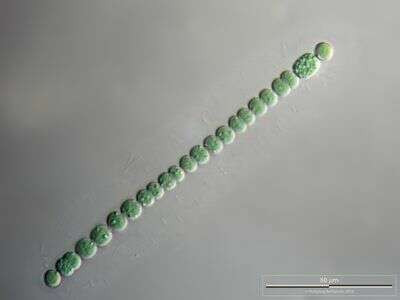 Colony of Cyanobacteria in Mucilaginous Sheath