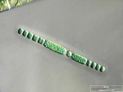 Microscopic Analysis of Hegne Moor Sample Near Lake Constance