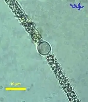 Aphanizomenon ovalisporum Heterocyte